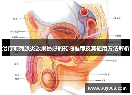 治疗前列腺炎效果最好的药物推荐及其使用方法解析